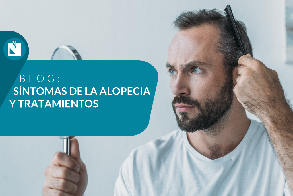 sintomas de la alopecia y tratamientos